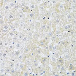 Anti-SLC4A5 antibody used in IHC (Paraffin sections) (IHC-P). GTX64690