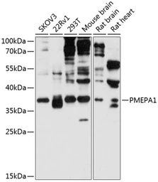 Anti-PMEPA1 antibody used in Western Blot (WB). GTX64694