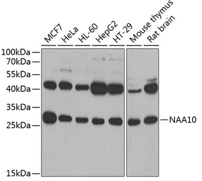 Anti-ARD1A antibody used in Western Blot (WB). GTX64704