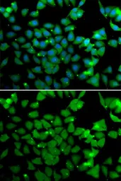 Anti-ARD1A antibody used in Immunocytochemistry/ Immunofluorescence (ICC/IF). GTX64704