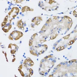 Anti-ARD1A antibody used in IHC (Paraffin sections) (IHC-P). GTX64704