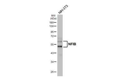 Anti-NFIB antibody [HL5837] used in Western Blot (WB). GTX647155