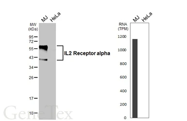 Anti-IL2 Receptor alpha antibody [HL5840] used in Western Blot (WB). GTX647158