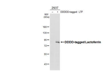 Anti-Lactoferrin antibody [HL5843] used in Western Blot (WB). GTX647161