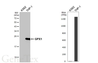 Anti-GPX1 antibody [HL5845] used in Western Blot (WB). GTX647163