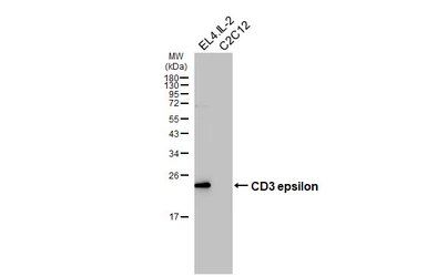 Anti-CD3 epsilon antibody [HL5848] used in Western Blot (WB). GTX647166