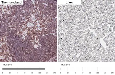 Anti-CD3 epsilon antibody [HL5848] used in IHC (Paraffin sections) (IHC-P). GTX647166