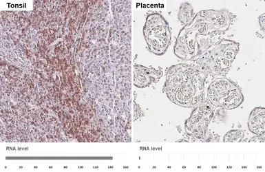 Anti-CD3 epsilon antibody [HL5848] used in IHC (Paraffin sections) (IHC-P). GTX647166