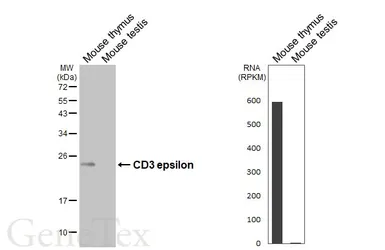 Anti-CD3 epsilon antibody [HL5848] used in Western Blot (WB). GTX647166