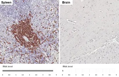 Anti-CD3 epsilon antibody [HL5848] used in IHC (Paraffin sections) (IHC-P). GTX647166
