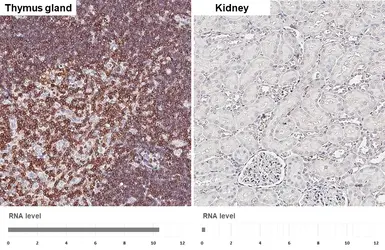 Anti-CD3 epsilon antibody [HL5848] used in IHC (Paraffin sections) (IHC-P). GTX647166