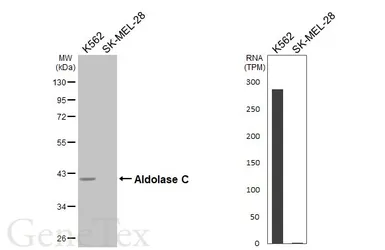 Anti-Aldolase C antibody [HL5849] used in Western Blot (WB). GTX647167