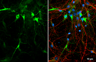 Anti-Aldolase C antibody [HL5849] used in Immunocytochemistry/ Immunofluorescence (ICC/IF). GTX647167