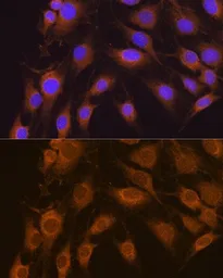 Anti-SEL1L antibody used in Immunocytochemistry/ Immunofluorescence (ICC/IF). GTX64717