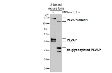 Anti-PLVAP antibody [HL5858] used in Western Blot (WB). GTX647176