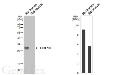 Anti-BCL10 antibody [HL5868] used in Western Blot (WB). GTX647192