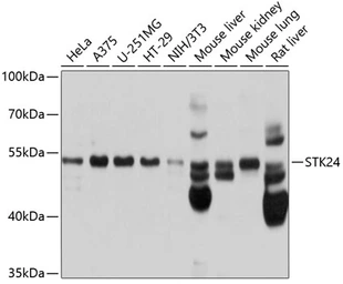 Anti-MST3 antibody used in Western Blot (WB). GTX64721