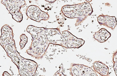 Anti-CD63 antibody [HL5889] used in IHC (Paraffin sections) (IHC-P). GTX647213