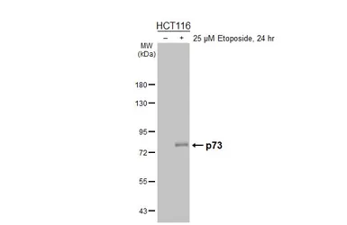 Anti-p73 antibody [HL5894] used in Western Blot (WB). GTX647218