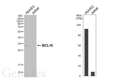 Anti-BCL10 antibody [HL5903] used in Western Blot (WB). GTX647227