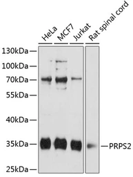 Anti-PRPS2 antibody used in Western Blot (WB). GTX64723