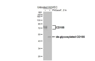Anti-CD155 antibody [HL5911] used in Western Blot (WB). GTX647236