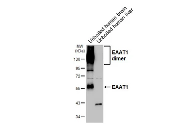 Anti-EAAT1 antibody [HL5912] used in Western Blot (WB). GTX647237