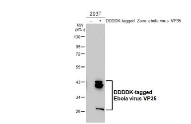 Anti-Ebola virus VP35 antibody [HL5918] used in Western Blot (WB). GTX647243