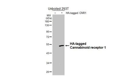 Anti-Cannabinoid receptor 1 antibody [HL5924] used in Western Blot (WB). GTX647249