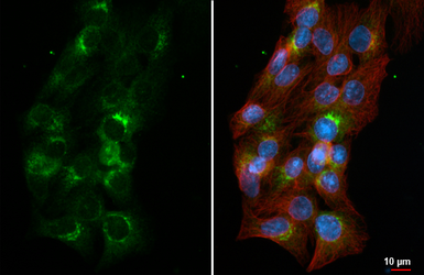 Anti-alpha 1 Antitrypsin antibody [HL5931] used in Immunocytochemistry/ Immunofluorescence (ICC/IF). GTX647256