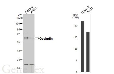 Anti-Occludin antibody [HL5934] used in Western Blot (WB). GTX647259