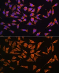 Anti-PMM2 antibody used in Immunocytochemistry/ Immunofluorescence (ICC/IF). GTX64726