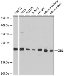 Anti-CIB1 antibody used in Western Blot (WB). GTX64728