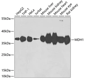 Anti-MDH1 antibody used in Western Blot (WB). GTX64737