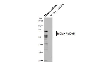 Anti-MDMX / MDM4 antibody [HL5947] used in Western Blot (WB). GTX647559
