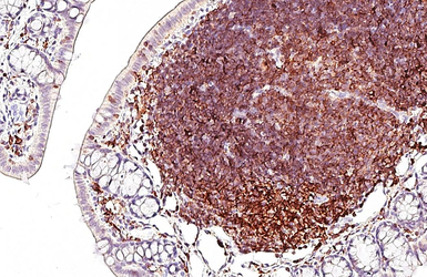 Anti-CD3 delta antibody [HL5955] used in IHC (Paraffin sections) (IHC-P). GTX647567