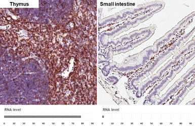 Anti-CD3 delta antibody [HL5955] used in IHC (Paraffin sections) (IHC-P). GTX647567