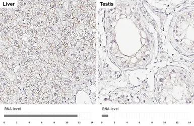 Anti-P Glycoprotein antibody [GT391] used in IHC (Paraffin sections) (IHC-P). GTX647572