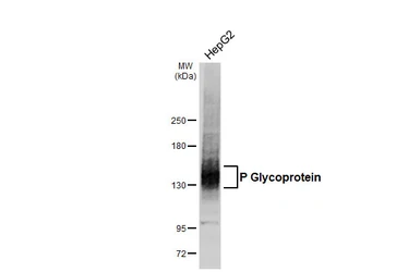 Anti-P Glycoprotein antibody [GT391] used in Western Blot (WB). GTX647572