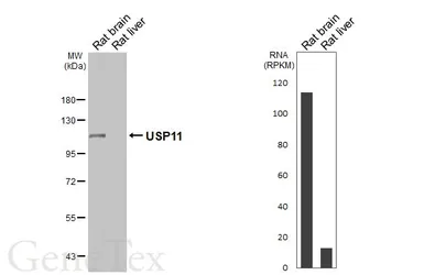 Anti-USP11 antibody [HL5963] used in Western Blot (WB). GTX647577