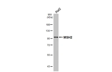 Anti-MSH2 antibody [HL5971] used in Western Blot (WB). GTX647585