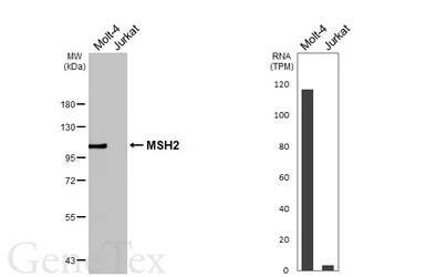 Anti-MSH2 antibody [HL5972] used in Western Blot (WB). GTX647586