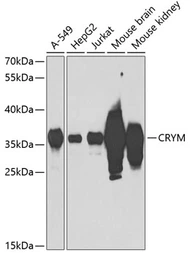 Anti-CRYM antibody used in Western Blot (WB). GTX64761