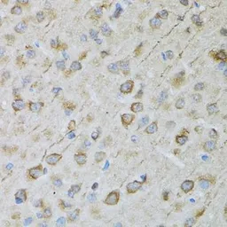 Anti-CRYM antibody used in IHC (Paraffin sections) (IHC-P). GTX64761