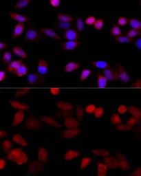 Anti-CYP1B1 antibody used in Immunocytochemistry/ Immunofluorescence (ICC/IF). GTX64767