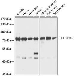 Anti-AChR alpha 9 antibody used in Western Blot (WB). GTX64774