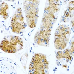 Anti-C8orf4 antibody used in IHC (Paraffin sections) (IHC-P). GTX64775