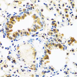 Anti-C8orf4 antibody used in IHC (Paraffin sections) (IHC-P). GTX64775