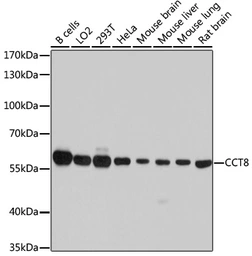 Anti-TCP1 theta antibody used in Western Blot (WB). GTX64792