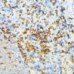 Anti-alpha 1 Spectrin antibody used in IHC (Paraffin sections) (IHC-P). GTX64806